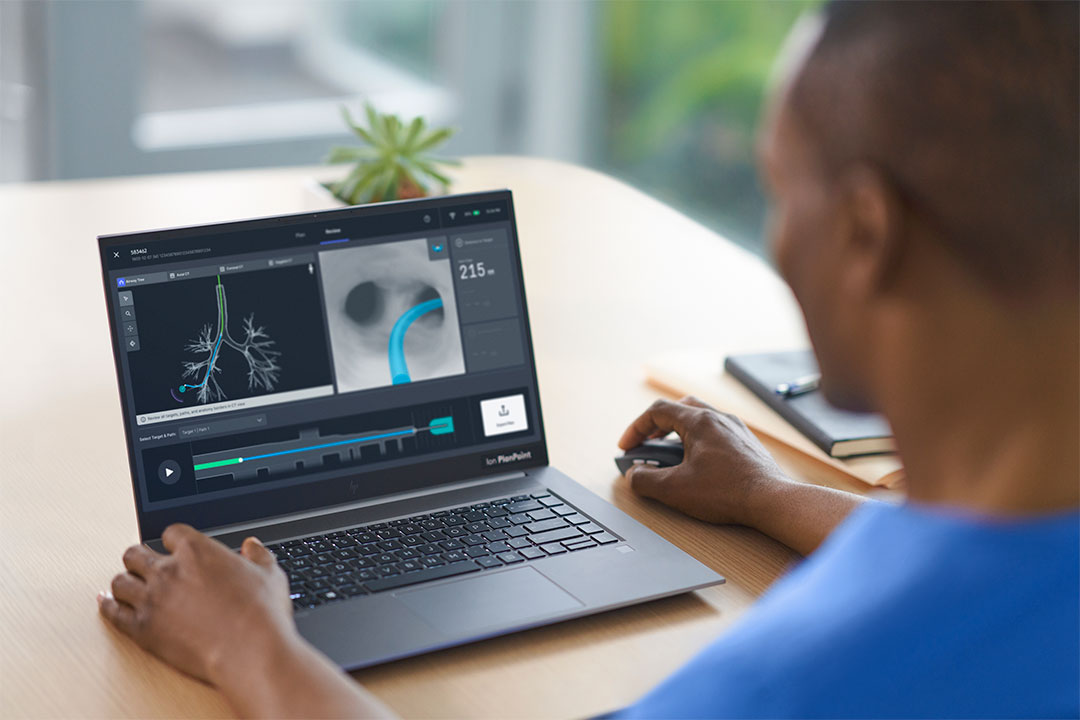 Ion Planning with PlanPoint Software