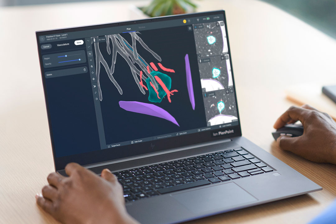 Ion PlanPoint software automatically generates 3D structures showing pleura or fissures
