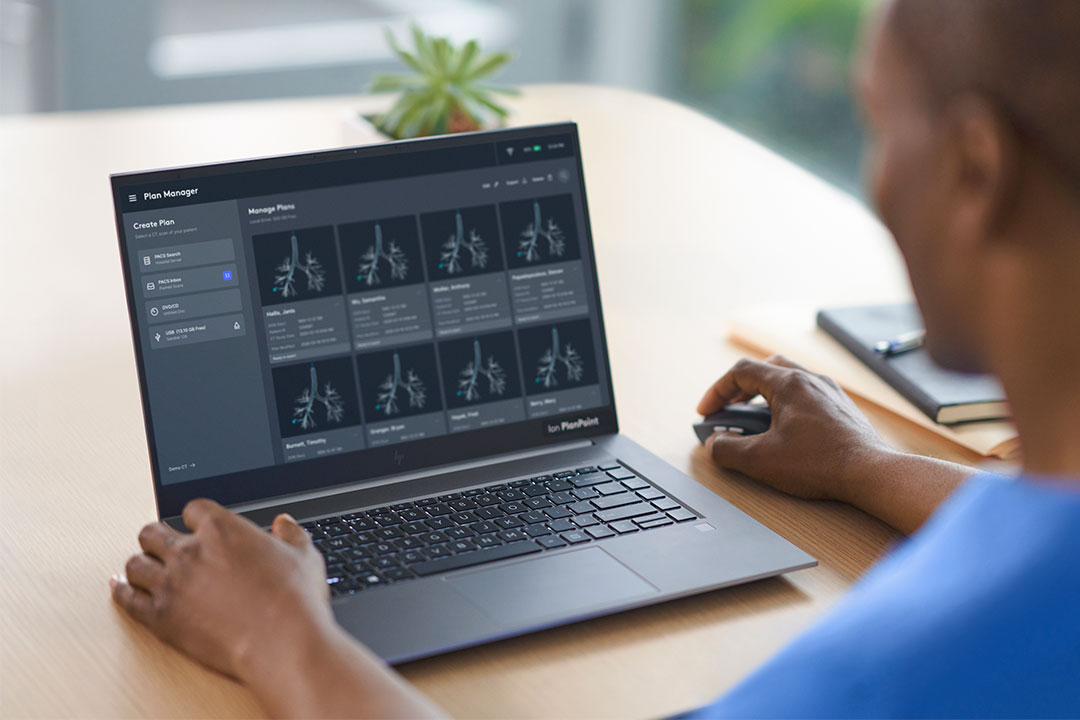 Ion PlanPoint software PACS integration