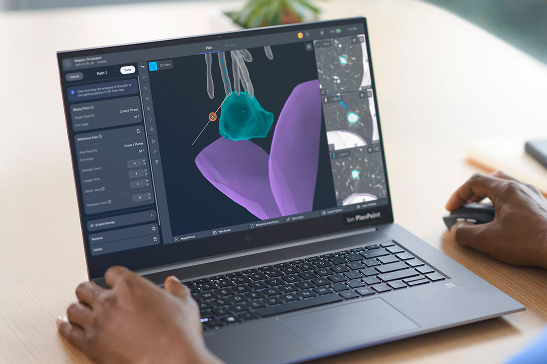Ion PlanPoint software can add airways as needed with the “Extend Airway” tool