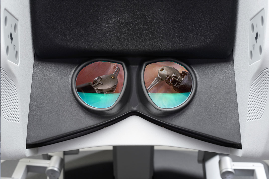 Image of viewers on surgeon console