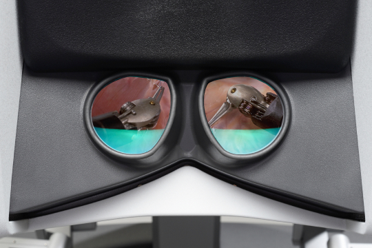 Image of viewers on surgeon console.