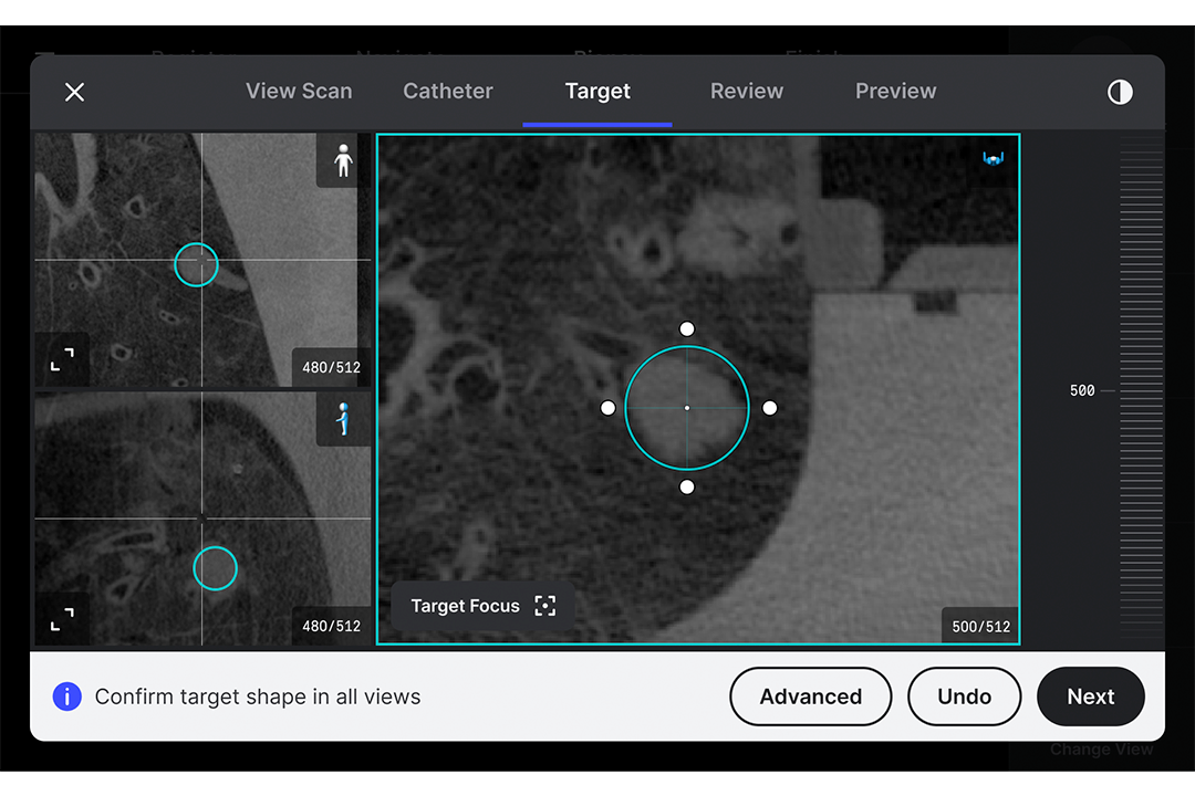 CBCT target screen