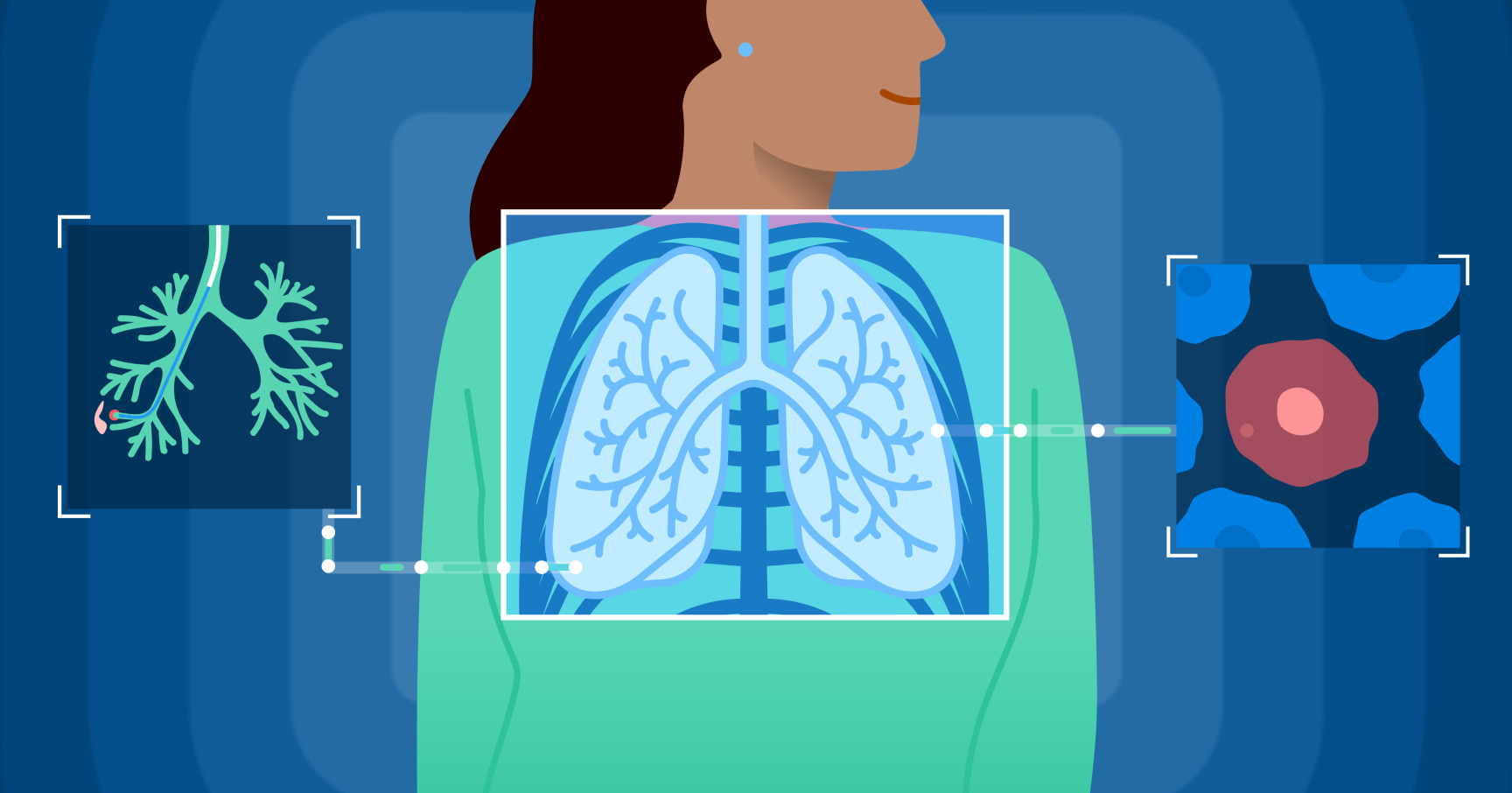 Illustration of lungs