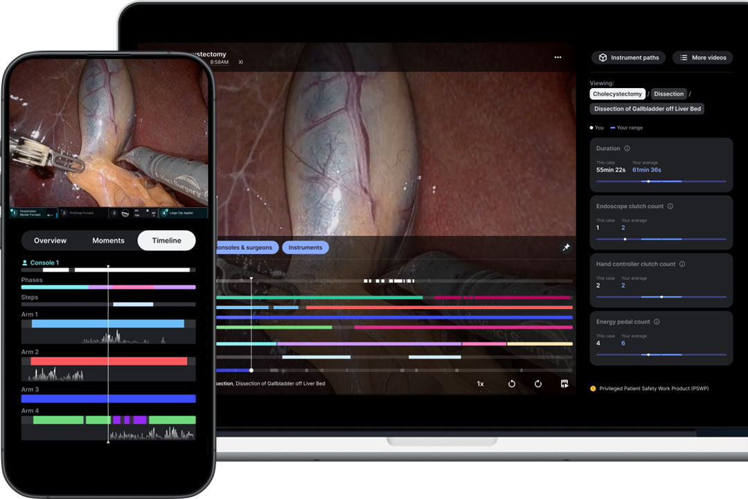 View of case insights on mobile device and laptop