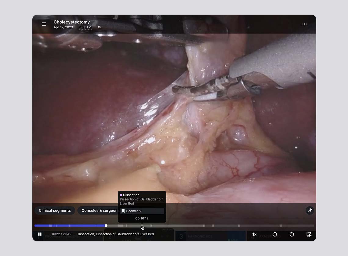 My Intuitive+ targeted video review