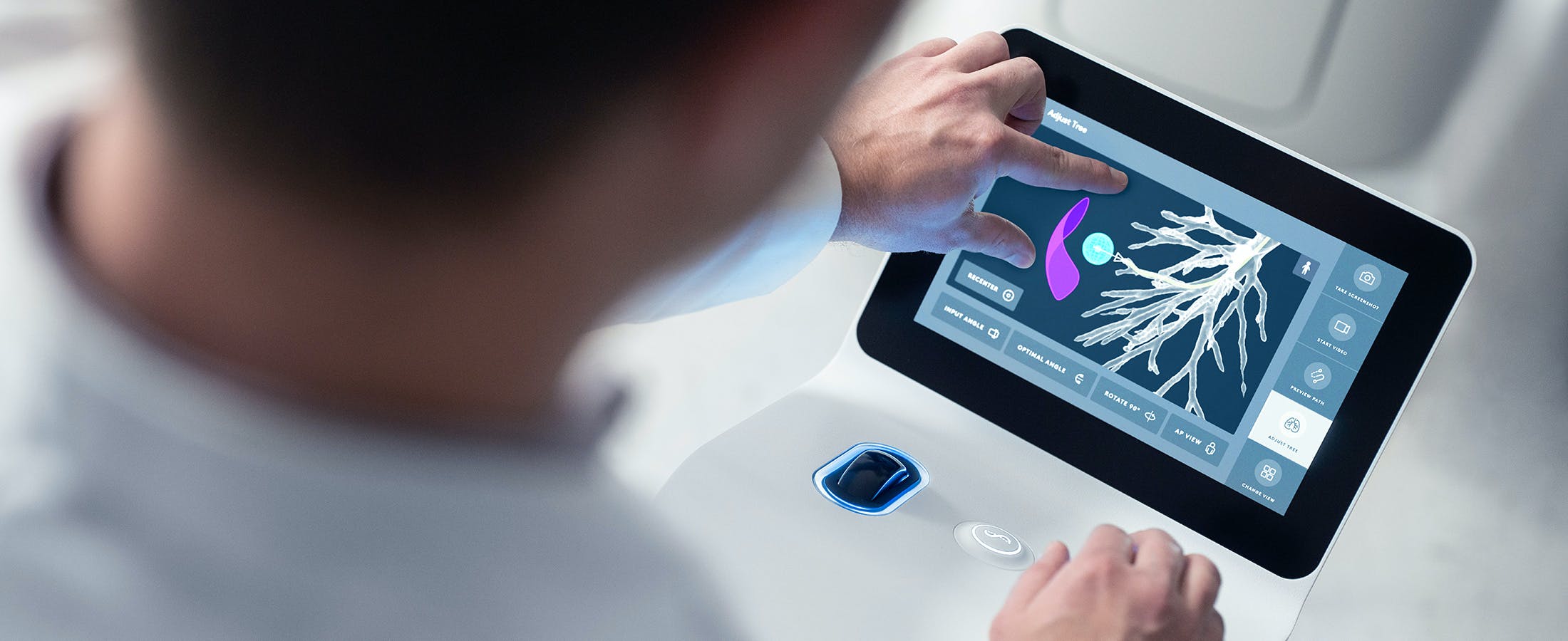 Physician using Ion navigation catheter system