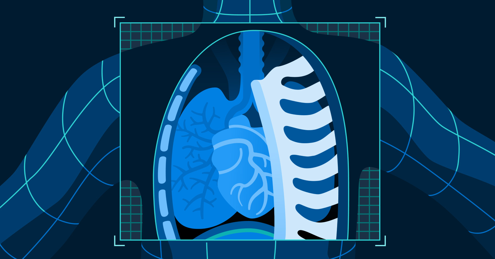 Illustration of an x-ray image of a chest