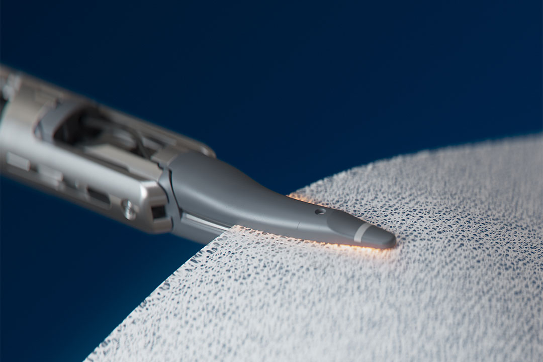 da Vinci Xi Vessel Sealer Curve Sealing