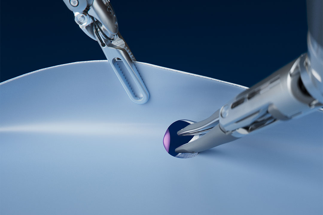 Vessel Sealer Curved