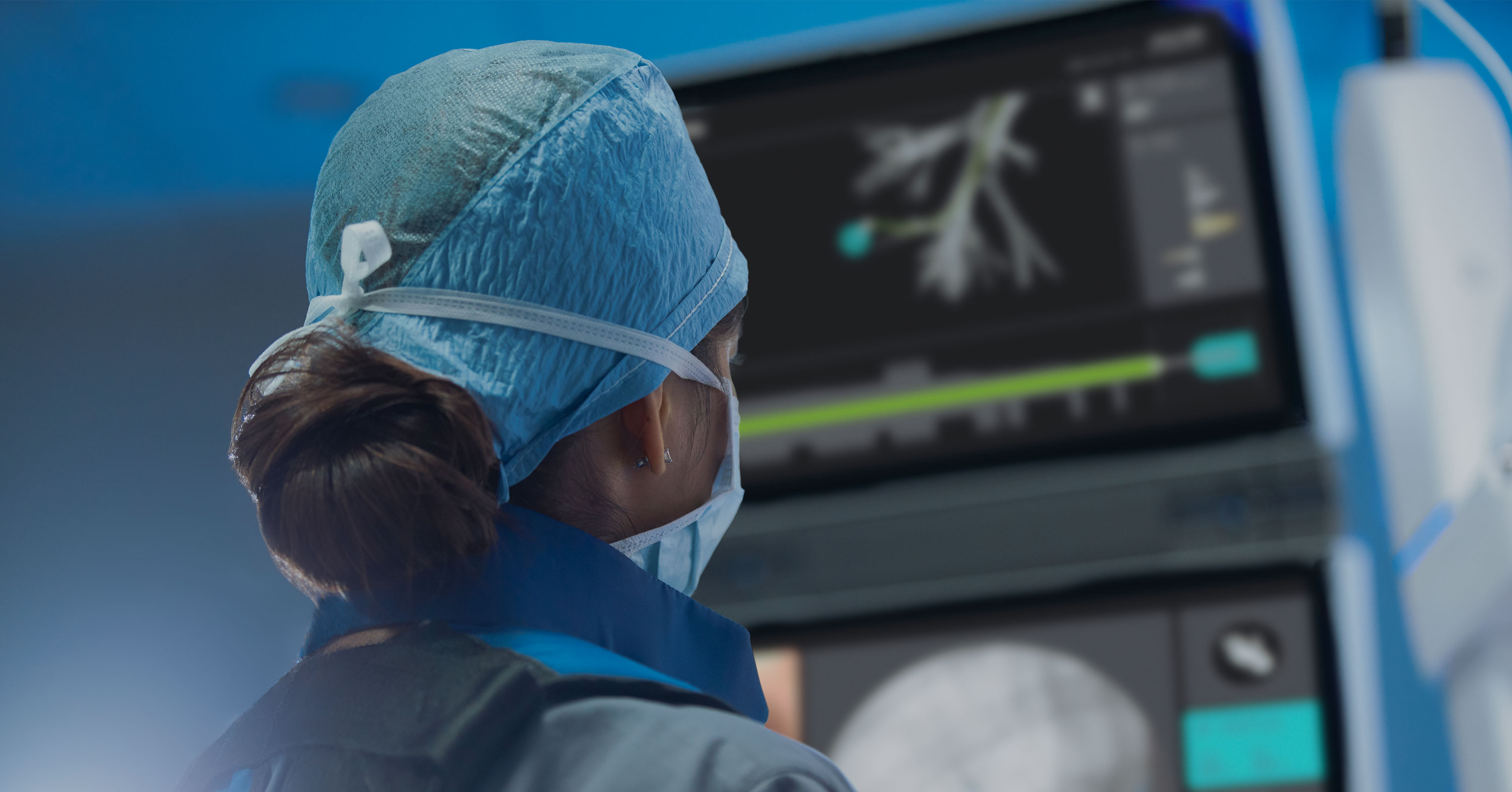 Clinician views lung airways on Ion screen