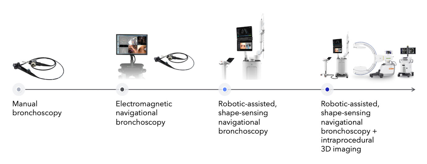 Timeline showing the evolution of bronchoscopy methods