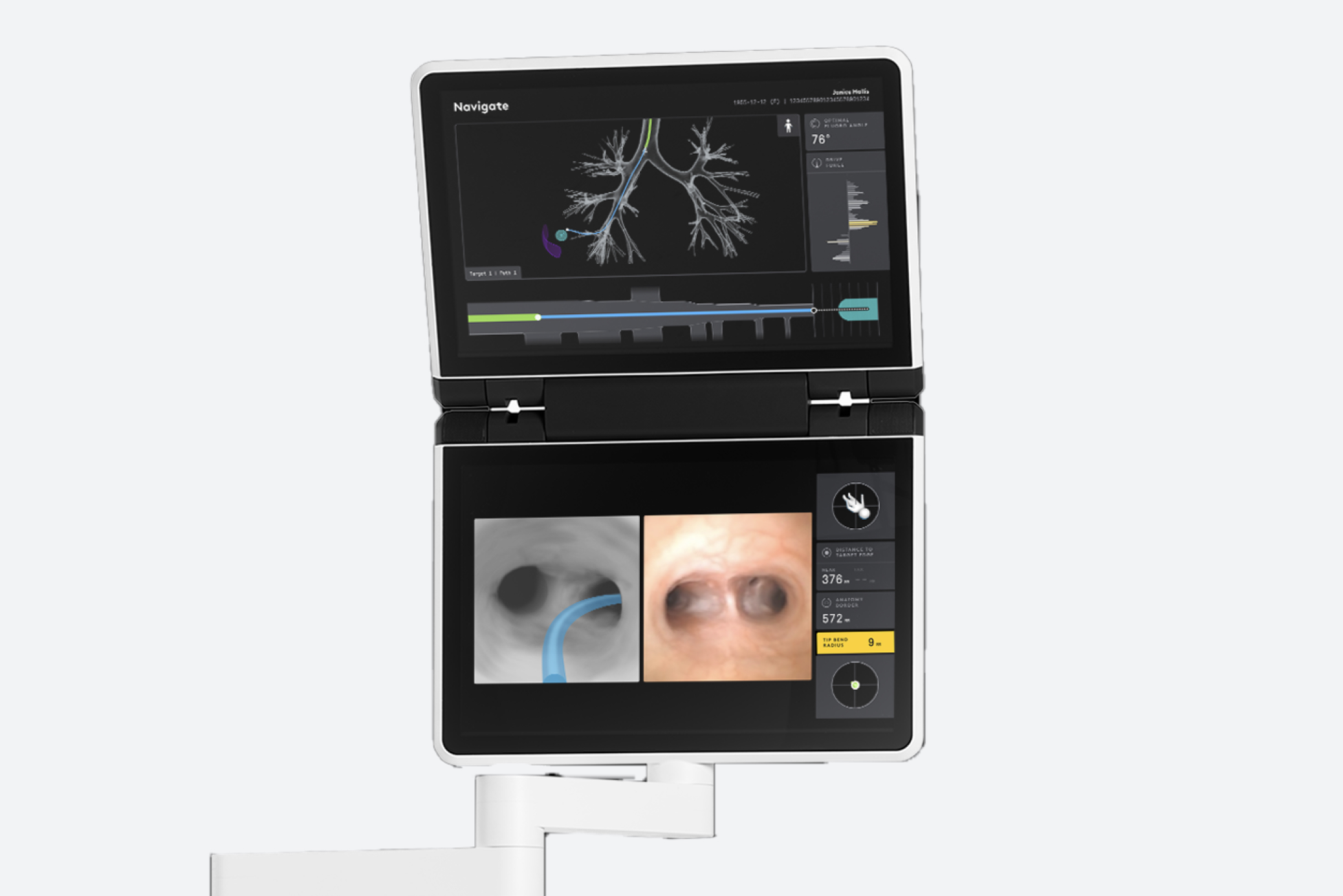 Ion visualization with two navigation views showing position