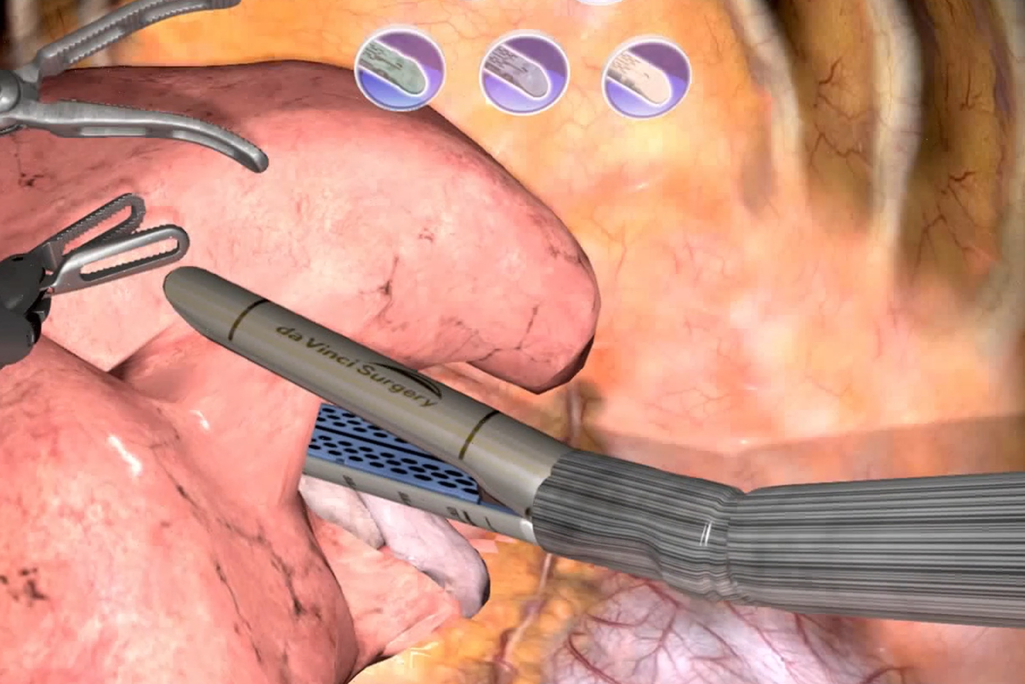 Da Vinci SureForm 60ステープラーを使用中のシミュレーター画面