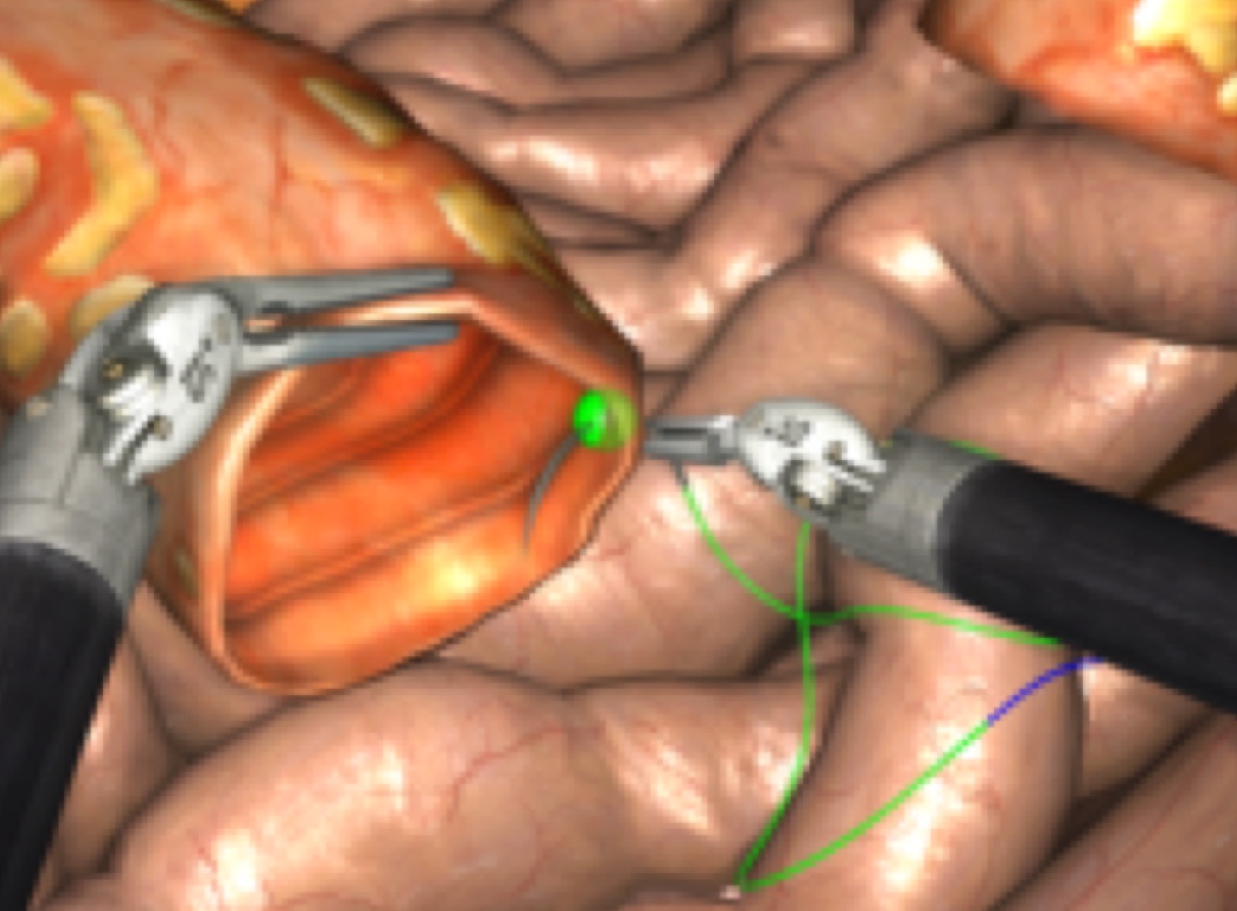 Da VinciソフトウェアSimNowシュミレーション