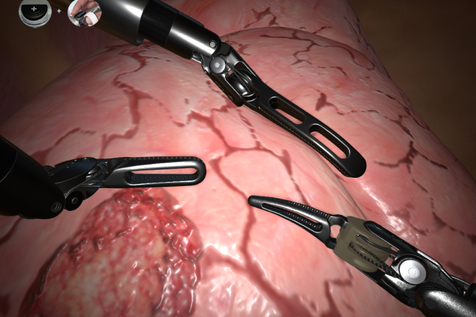 SimNow lobectomy procedure module simulation view