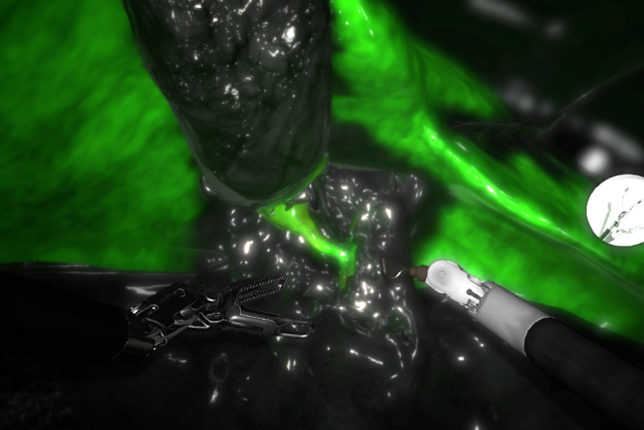 SimNow cholecystitis module showing da Vinci Firefly